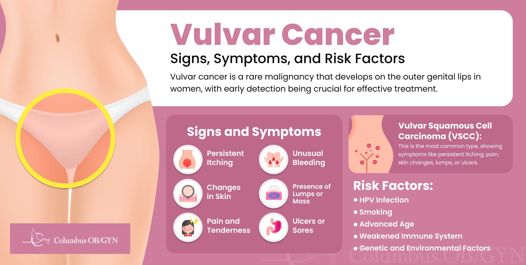 Infographic: Vulvar Cancer Signs, Symptoms, and Risk Factors