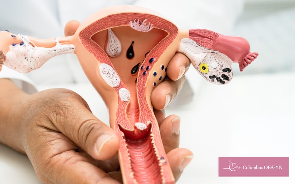 Doctor holding an anatomical model of a uterus during a medical explanation.
